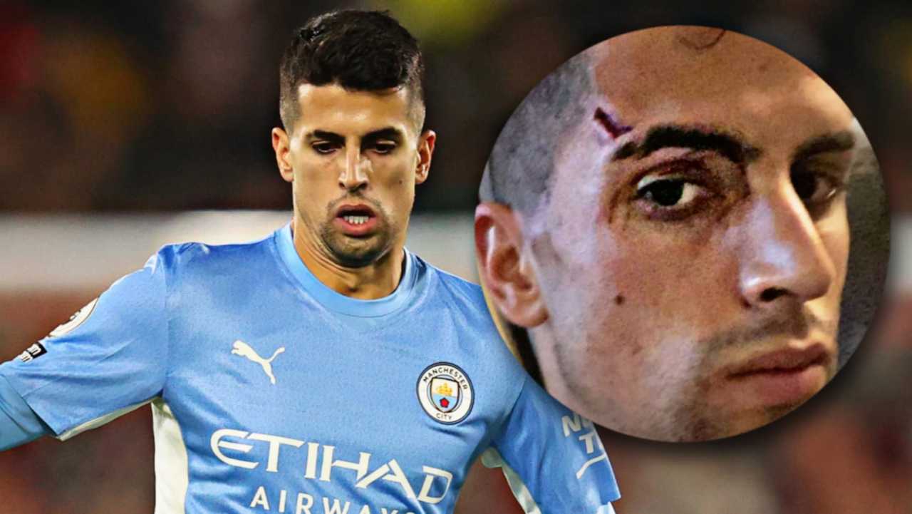 Joao Cancelo ferito